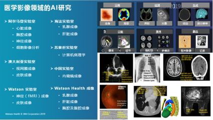 IBM Watson Health:AI助力智慧医疗新未来